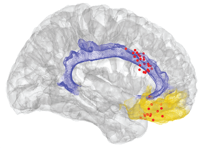 Prasad Shirvalkar brain scan chronic pain